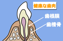 健康な歯肉